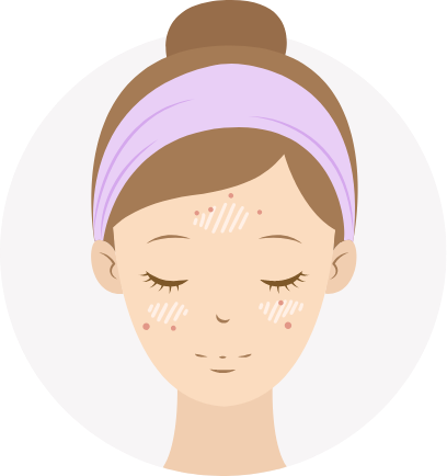 skin type