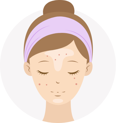 skin type